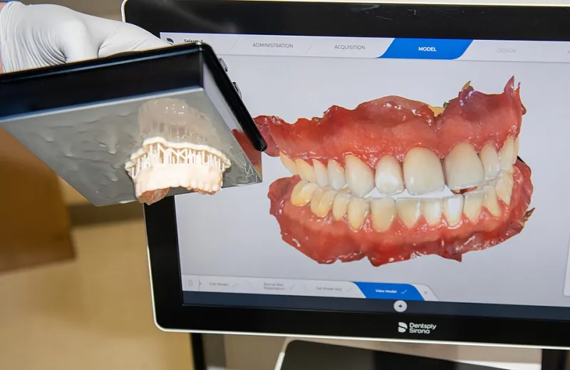 See It Before You Commit: How Digital Smile Technology Is Changing the Way We Plan Treatments